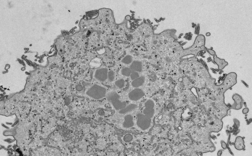 Photographie en microscopie électronique de cellule épithéliale pulmonaire humaine infectée par un virus H7N1